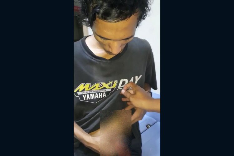 Remaja Ini Terkena Anak Panah Diduga dari Geng Motor, Polisi: Kita Kejar