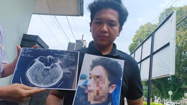 Kasus Taruna Akmil Diduga Aniaya Mahasiswa UISU Ditarik Poldasu dari Polrestabes Medan