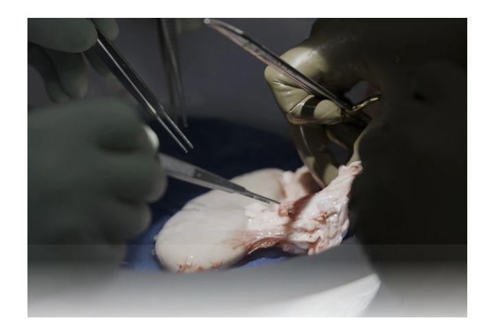 Pertamakali! Ahli Bedah AS Berhasil Transplantasi Ginjal Babi ke Manusia