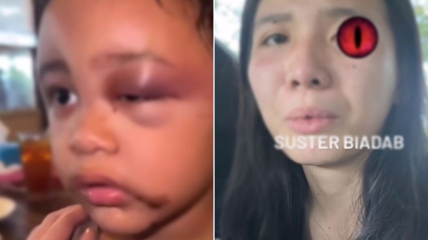 Viral Selebgram di Malang Ungkap Babysitter Aniaya Anak Balitanya hingga Muka Lebam