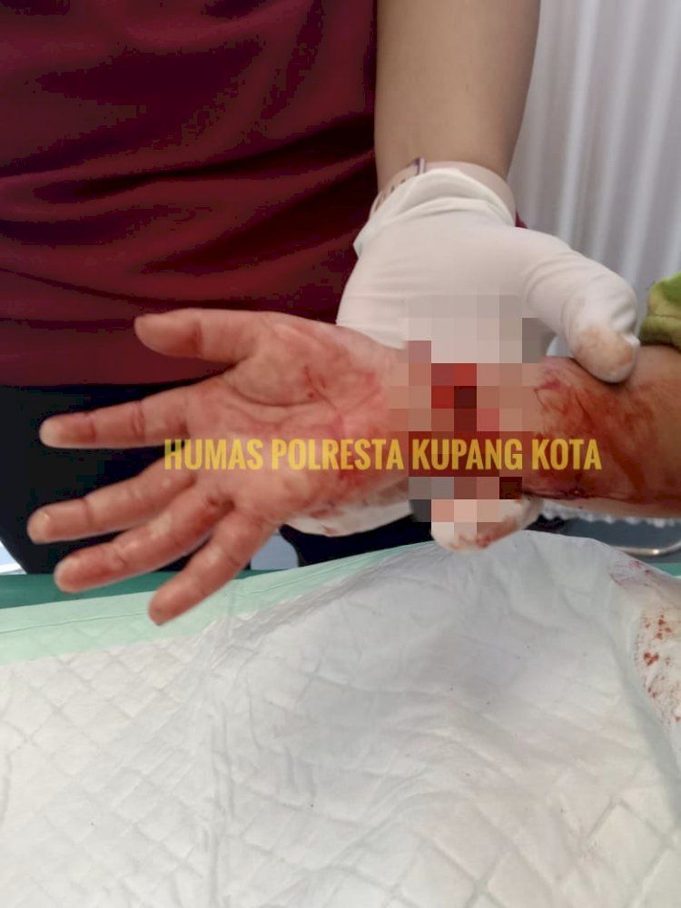 Tragis! Seorang Anak Nyaris Jadi Korban Pembunuhan oleh Ibu Kandung