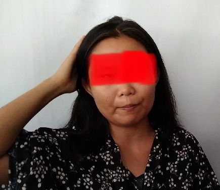 Dianiaya Suami Hingga Babak Belur, Ibu Muda ini Lapor ke Polres Tebing Tinggi